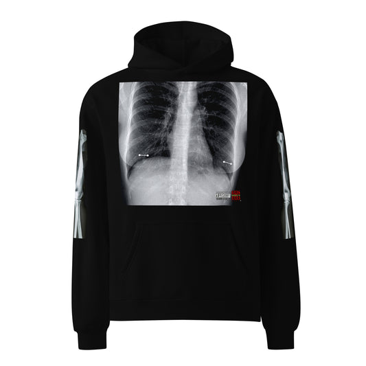 Female GSC XRAY GSC B Unisex oversized hoodiee